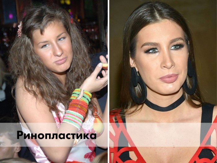 Алекса давай поженимся до пластики
