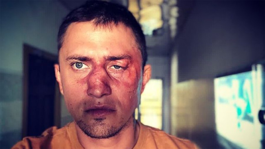 Павел Прилучный после драки